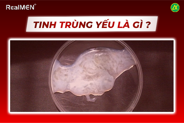 Tinh trùng yếu thường có hình dạng bất thường